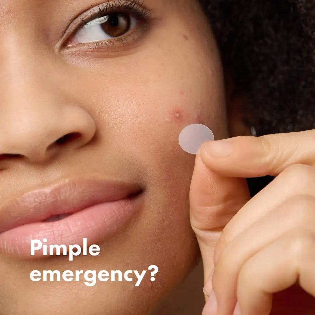 Mighty Patch™ Original patch from Hero Cosmetics - Hydrocolloid Acne Pimple Patch for Covering Zits and Blemishes in Face