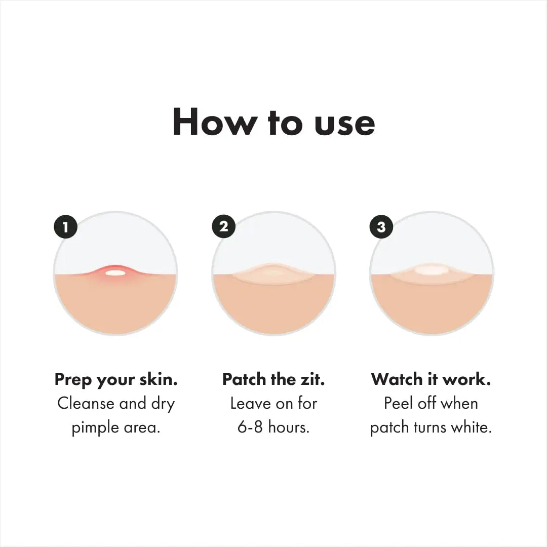 Mighty Patch™ Original patch from Hero Cosmetics - Hydrocolloid Acne Pimple Patch for Covering Zits and Blemishes in Face